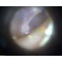 DinoLite otoscope EarScope Pro