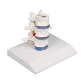 Erler Zimmer 4047 lumbar vertebrae model with stand