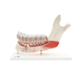 3B Scientific 19-part lower half jaw model with diseases