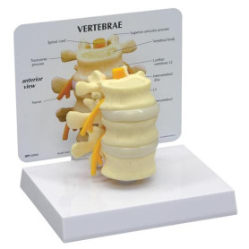 GPI Anatomicals lumbar vertebrae model